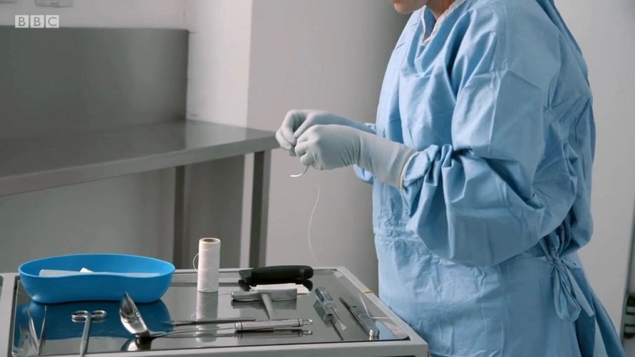 Obesity: The Post Mortem Background