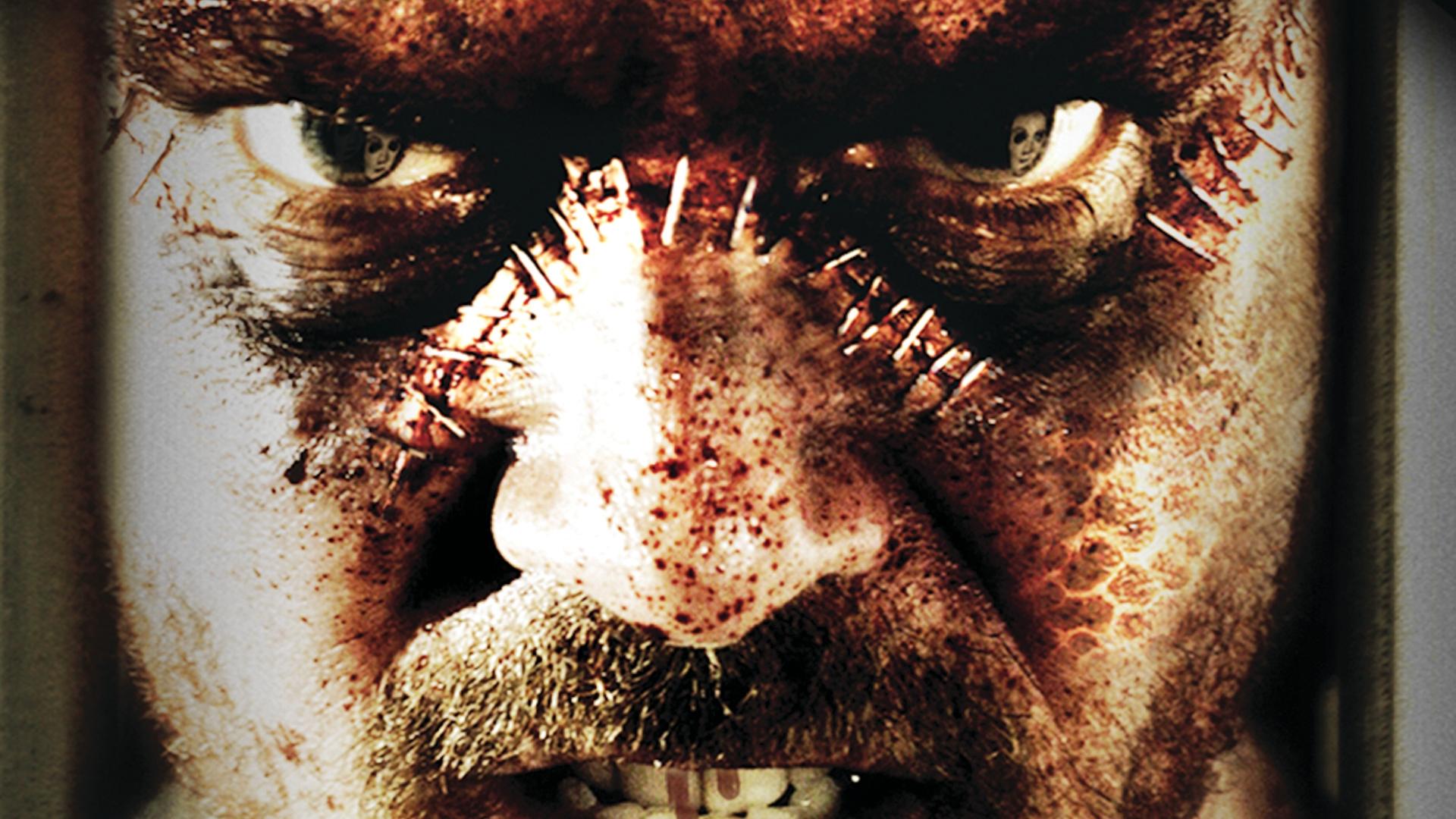 The Frankenstein Syndrome Background